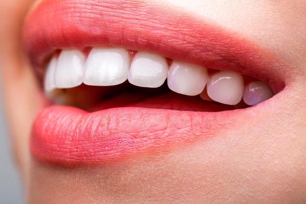 Estética Dental